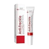 Whitening Freckle Cream, Pigmentflecken Entferner Gesicht, Aufhellungscreme...