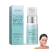 Dark Spot Pigmentflecken Entferner, Creme Gegen Pigmentflecken, Altersflecken...