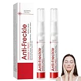 2 Stück Anti Pigmentflecken Creme, Pigmentflecken Entferner Gesicht & Altersflecken Creme mit Niacinamid & Vitamin C, Anti Freckle Gesichtscreme Damen, Dark Spot Remover, Verbessert Mattheit, 2×15g