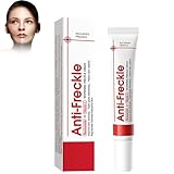 Aufhellungscreme Korrektorcreme,Aufhellungscreme Gegen Dunkle Flecken Im...