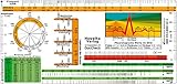 EKG Lineal -professional- II - inkl. Lagetypen, Lagekreis, Periodendauer