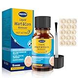 MQUPIN Hühneraugen Entferner Lösung, Corn Remover, Lösung gegen Hühneraugen...