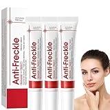 Soleneva 3 Stück Anti Freckle, Gegen Pigmentflecken & Altersflecken, Anti Aging Creme für Frauen, Gesichtscreme Damen zur und Faltenreduzierung, Altersflecken Entfernen Facial Treatment