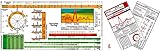 EKG Lineal professional II + EKG Normgrößen & Lagetypen Med. Taschenkarte
